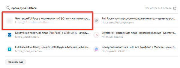Нейровыдача Алисы